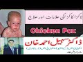 Chicken Pox | Kakra ka ilaj | Chicken Pops | Lakrha Kakra | Chicken Pox ka ilaj in Urdu | Pox virus