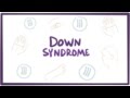 Down syndrome (trisomy 21) - causes, symptoms, diagnosis, & pathology
