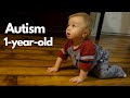 12 Signs of Autism in a 1-year-old