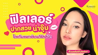 เติมฟิลเลอร์ปาก สวย น่าจุ๊บบ.. | รณภีร์คลินิก