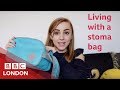 Living with a stoma bag (feat Hanna Witton) - BBC London