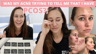 Hormonal Acne and PCOS? – MY POLYCYSTIC OVARIAN SYNDROME PCOS DIAGNOSIS RESULTS!? Freezing my eggs?