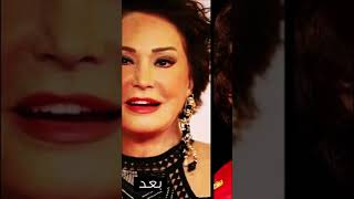 7 فنانات دمرتهم عمليات التجميل الفاشلة | رقم 6 هتصدمك