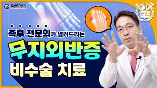 무지외반증 비수술 치료도 가능?! 발가락 통증 잡는 3가지 비법!