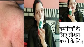 घमौरियों के लिए सबसे अच्छा लोशन बच्चों के लिए #ghamoriya #babylotion #mylifepreeti #calosoft-AF