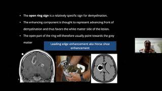 NEUROIMAGING SPOTTERS 1 Dr SHARATH