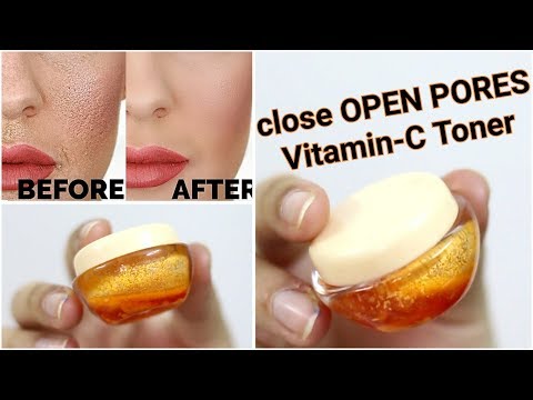 How to close LARGE OPEN PORES & tighten skin - VITAMIN-C Toner How to close LARGE OPEN PORES & tighten skin - VITAMIN-C Toner