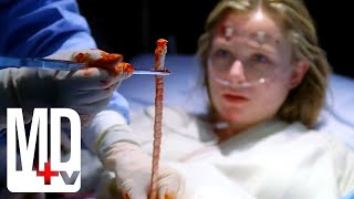 Removing a 25ft Tape Worm | House M.D. | MD TV