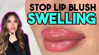 AVOID LIP BLUSH TRAMA AND SWELLING
