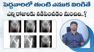 #fractureseries హిప్ ఫ్రాక్చర్స్|| Intertrochanteric hip treatment||Dr. Vamshis Orthopaedic Center