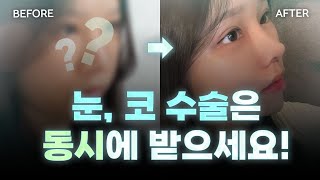 얼마나 예뻐졌는지 궁금하시죠?! (ft. 마인드성형외과 - 이현건 원장님)