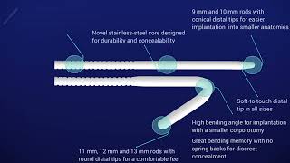 Rigi10™ Features and Benefits at a Glance