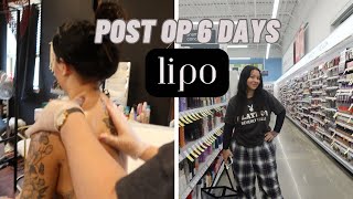 VLOG: Post Op 6 days and ranting about my mental health!