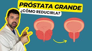 ENLARGED PROSTATE Discover How to Reduce the Prostate