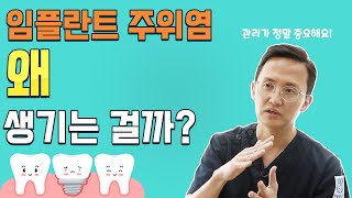 임플란트 주위염 왜 생기는 걸까? [성남서울플러스치과]