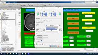 MRI Brain Tumor Detection using SVM in Matlab