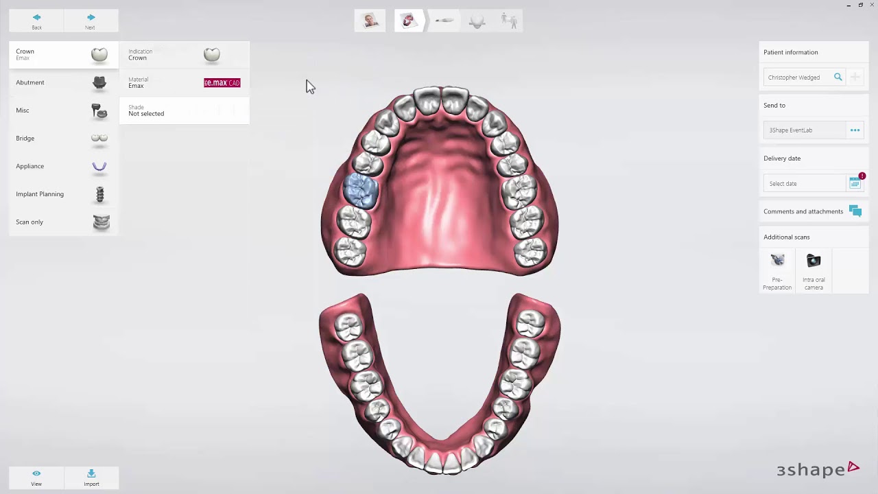 Introduction To 3Shape TRIOS On Dental Desktop - YouTube