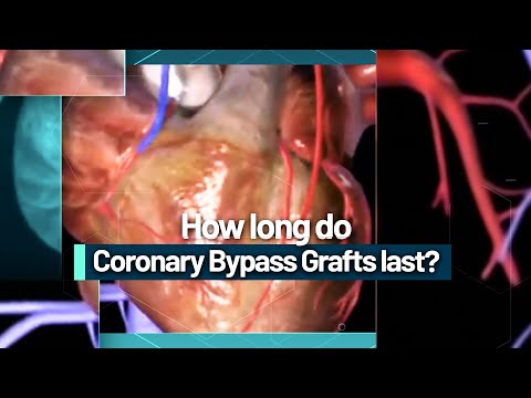 How long do artery grafts last?