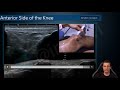 knee ultrasound part 1 4 anterior side