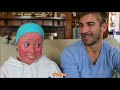 life as a teen with harlequin ichthyosis school boys drama and a rare skin disorder