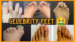 WHY CELEBRITIES ARE REVEALING THEIR UGLY FEET  🤔😱