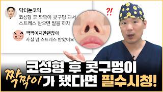 기껏 코수술 했는데 콧구멍이 짝짝이가 됐다구요?! 콧구멍 짝짝이 원인과 해결 방법 알려드리겠습니다! [코성형][코성형수술]