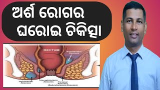 ଅର୍ଶ ରୋଗର ସମ୍ପୂର୍ଣ୍ଣ ଘରୋଇ ଚିକିତ୍ସା | piles treatment at home | piles symptoms odia |