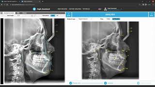 Tutorial 2.1: How to make a cephalometric analysis?