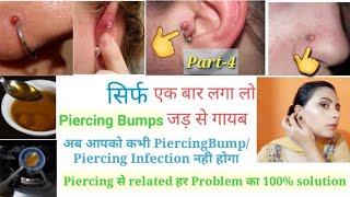 Piercing bumps/infection गायब करने का आसान व घरेलू उपाय Piercing से जुड़े हर सवाल का जवाब l Part-4