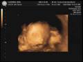 24-week ultrasound of Olivia