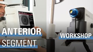 WORKSHOP: Anterior Segment Imaging | ANTERION \u0026 SPECTRALIS Anterior Segment Module (ASM)