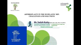 Arthroplasty in Dysplastic Hips for Orthopaedic FRCS Exams - Challenges and Solutions