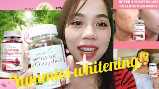 NATURE GLOW GLUTATHIONE COLLAGEN GLOW, SKIN WHITENING GUMMIES Ms Sungit