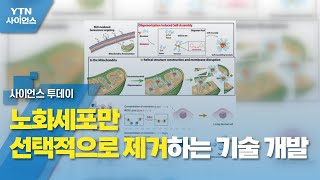 노화세포만 선택적으로 제거하는 기술 개발 / YTN 사이언스