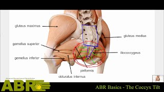 ABR Basics - The Coccyx Tilt. By Leonid Blyum.