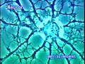 科学映像館 medical　neuron　ニューロン