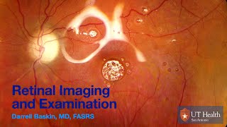 Retina Imaging and Exam 2024