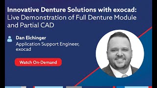 On-Demand Webinar: Innovative Denture Solutions with exocad: Full Denture Module \u0026 Partial CAD