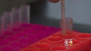 Dr. Max Gomez: Concussion Blood Tests