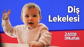 Diş Lekelenmesi Neden Olur? Diş Lekelenmesi Nasıl Geçer? #4 I Bebek Gelişimi ve Bebek Sağlığı