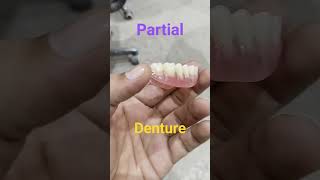 Upper Removable Partial Denture By Haider #dentalartbyhaider #dentures #rpd #dentur #orthodontic