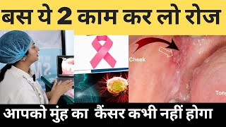 मुंह के कैंसर से बचने के घरेलू तरीके | Home Remedies To Prevent Oral Cancer | #oralcancer