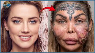Famous Celebrities Unrecognizable After Plastic Surgery Gone Wrong | Then and Now 2026