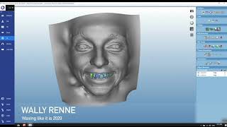 Planmeca Romexis 6: groundbreaking all-in-one software