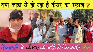 देवमाली गाँव में कैंसर का ईलाज कैसे हों रहा है | Devmali how is cancer being treated in the village?