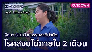 Cutdown I รักษา SLE ด้วยธรรมชาติบำบัด โรคสงบภายใน 2 เดือน !