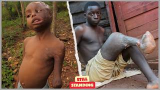 21 Most Unusual Babies Ever Born With Rare and Extraordinary Features – Rare People