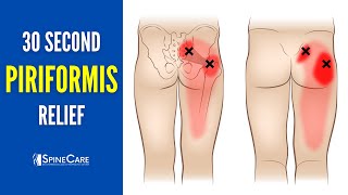 30 SECOND FIX: Instant Piriformis Pain Relief
