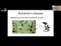 defining the typical progression of alzheimer’s disease