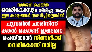 ചുവരിൽ ചാരിനിന്ന് കാൽ കൊണ്ട് ഇങ്ങനെ ചെയ്താൽ നിങ്ങൾക്ക് വെരികോസ് വരില്ല | vericose vein problem in